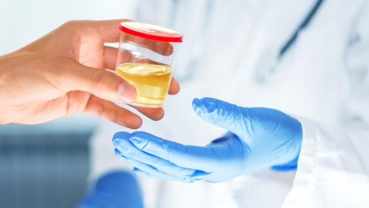 Ciri-ciri Gagal Ginjal yang Terlihat dari Air Kencing