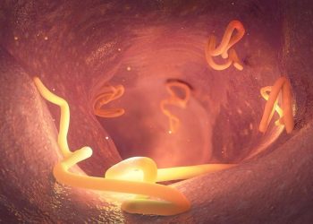 Kasus Cacingan Menurun Kemenkes Ingatkan Pentingnya Mencegah Infeksi Berulang