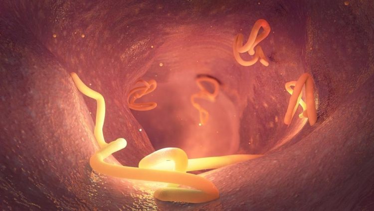 Kasus Cacingan Menurun Kemenkes Ingatkan Pentingnya Mencegah Infeksi Berulang