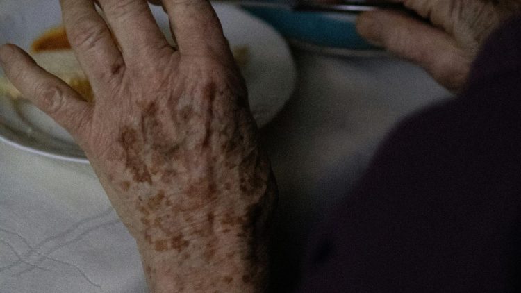 Nenek di Bantul Tewas, Pakar Duga Bukan karena Sengatan Tawon tapi Lebah Hutan Besar