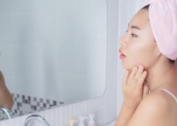 Penyebab Jerawat Hormonal dan Cara Mengatasi Agar Tidak Berbekas