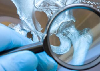 7 Jenis Makanan yang Harus Dihindari Penderita Asam Urat